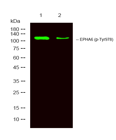 Rabbit anti-Phospho-EPHA6 (Tyr977)Polyclonal Antibody