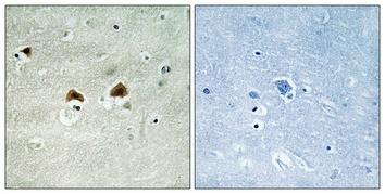 Rabbit anti-Phospho-MAP4 (Ser696)Polyclonal Antibody