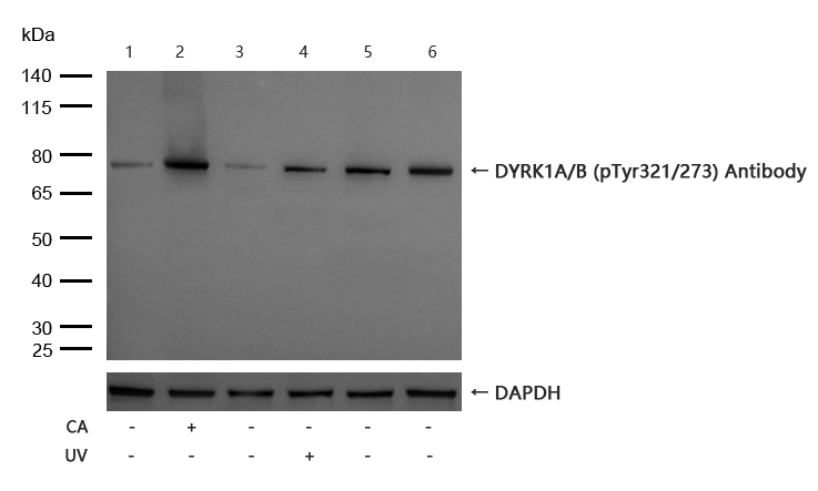 Rabbit anti-Phospho-DYRK1A/B (Tyr321/273)Polyclonal Antibody