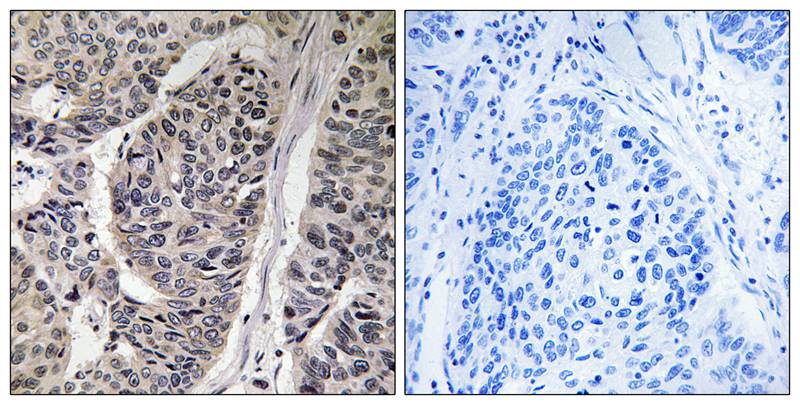 Rabbit anti-Phospho-p130 Cas (Tyr410)Polyclonal Antibody