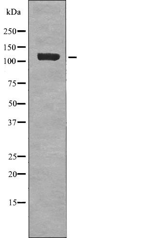 Rabbit anti-Phospho-EPHB1/2 (Tyr778/Tyr780)Polyclonal Antibody