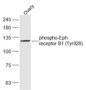 Rabbit anti-Phospho-EPHB1 (Tyr928)Polyclonal Antibody