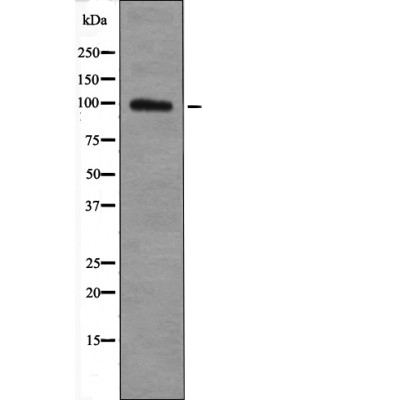 Rabbit anti-Phospho-TGF β Receptor III (Thr842)Polyclonal Antibody