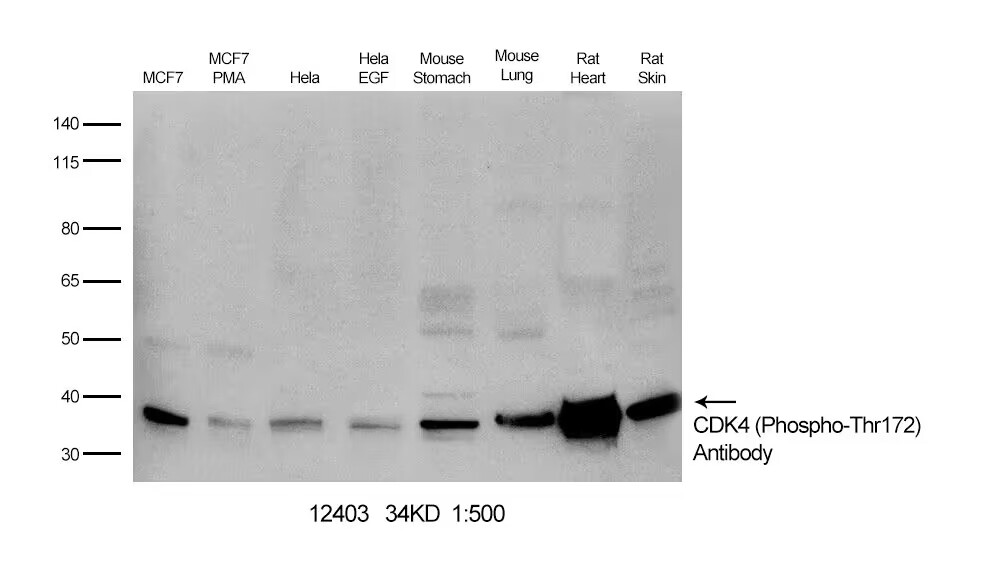 Rabbit anti-Phospho-CDK4 (Thr172)Polyclonal Antibody