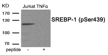 Rabbit anti-Phospho-SREBP-1 (Ser439)Polyclonal Antibody
