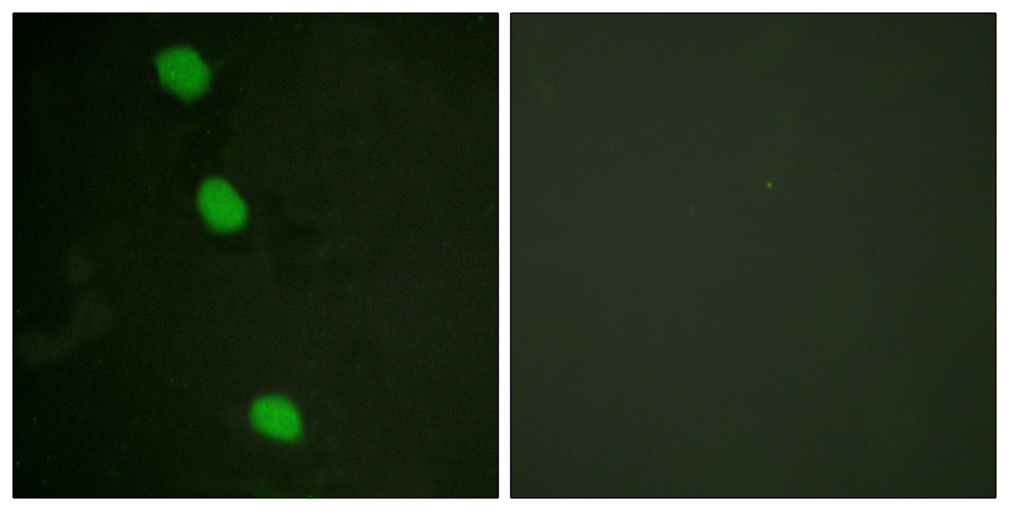 Rabbit anti-Phospho-CaMK4 (Thr196/200)Polyclonal Antibody