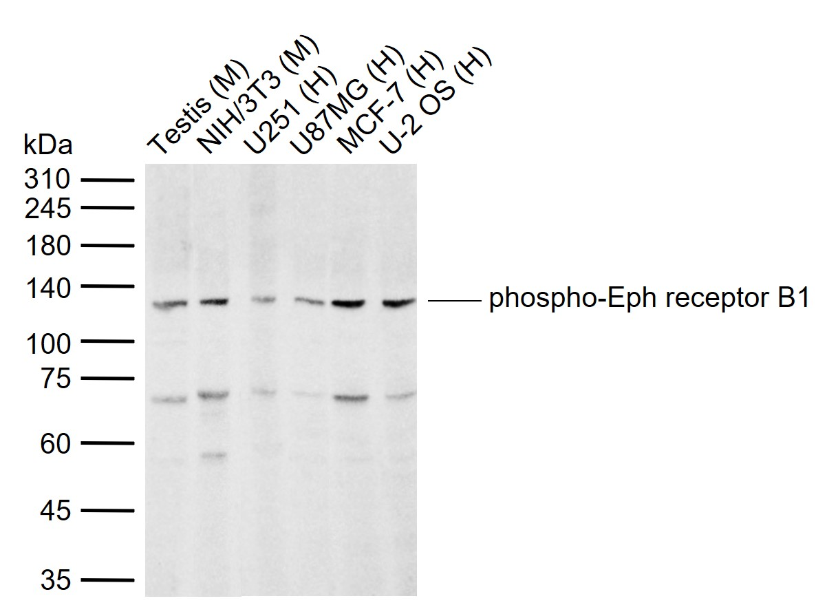 Rabbit anti-Phospho-EPHB1 (Tyr928)Polyclonal Antibody