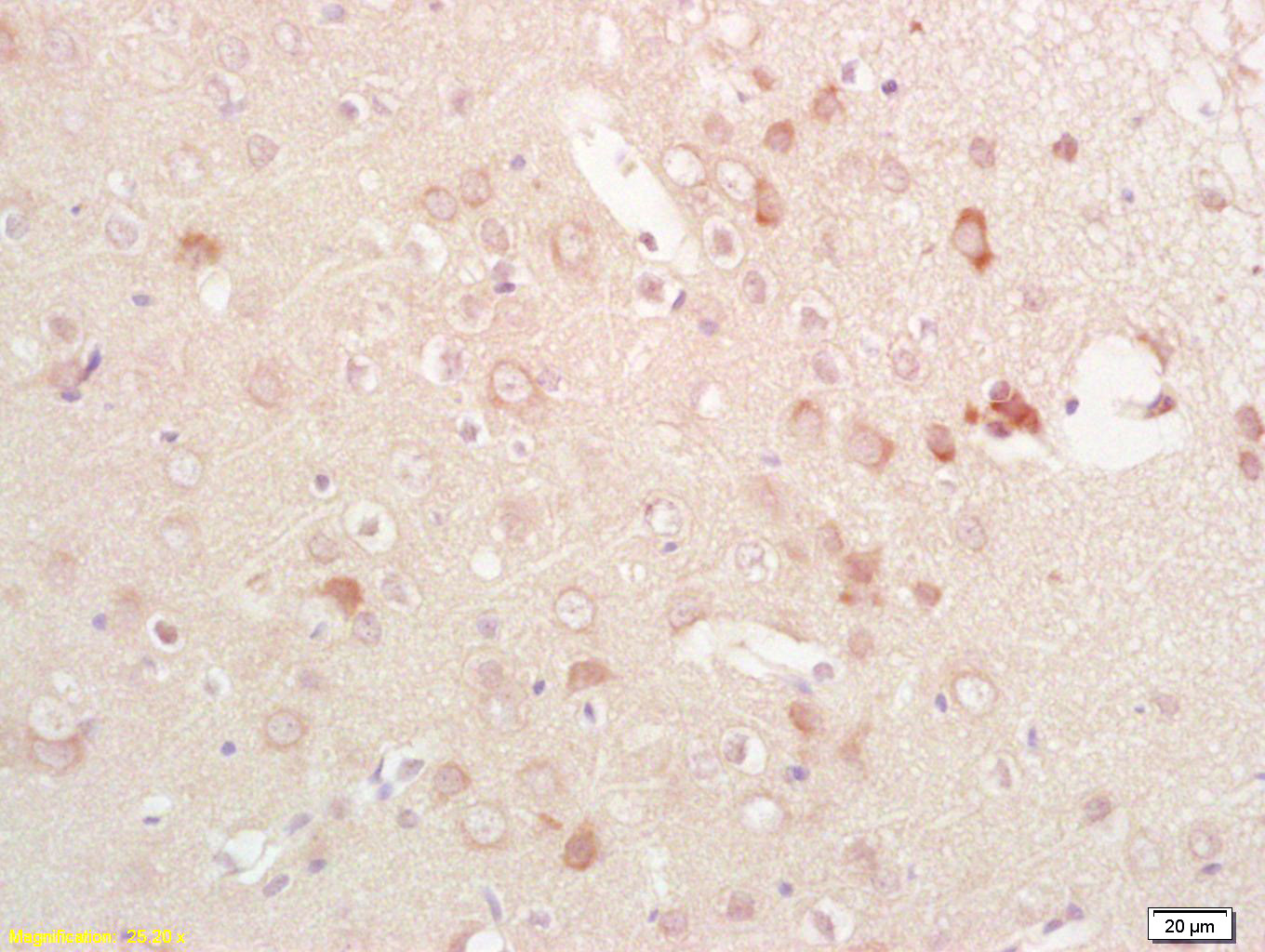 Rabbit anti-Phospho-EPHB1 (Tyr928)Polyclonal Antibody