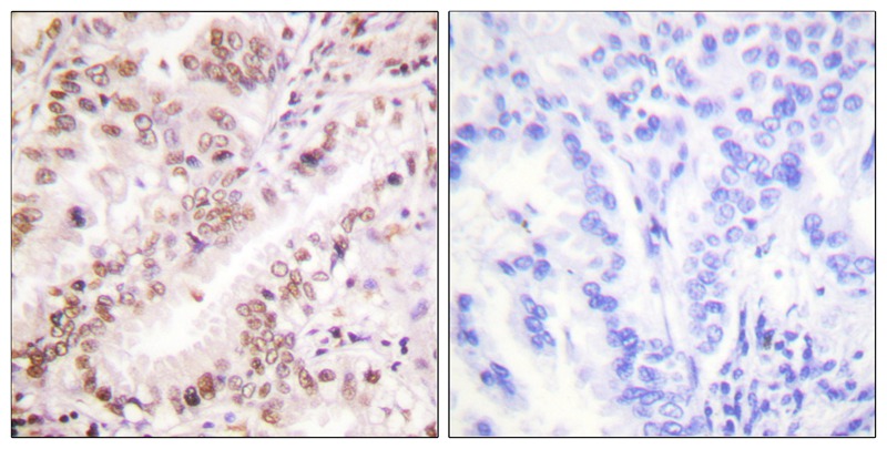Rabbit anti-Phospho-Estrogen Receptor-α (Tyr537)Polyclonal Antibody