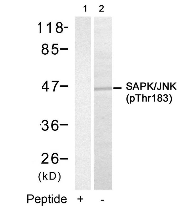 Rabbit anti-Phospho-SAPK/JNK(Thr183)Polyclonal Antibody