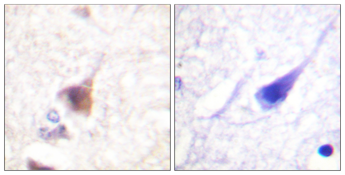 Rabbit anti-Phospho-CaMK4 (Thr196/200)Polyclonal Antibody