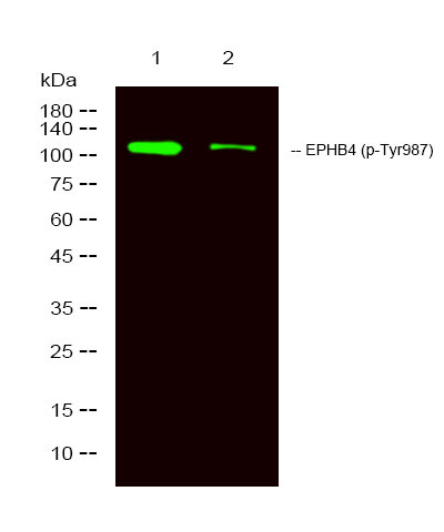 Rabbit anti-Phospho-EPHB4 (Tyr987)Polyclonal Antibody