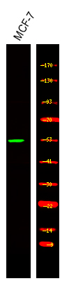 Rabbit anti-Phospho-Retinoic Acid Receptor α/β (Ser96)Polyclonal Antibody