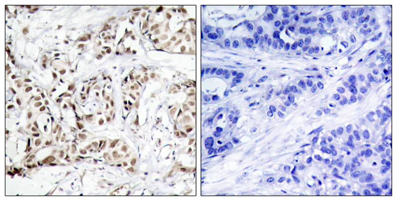 Rabbit anti-Phospho-SAPK/JNK(Thr183)Polyclonal Antibody
