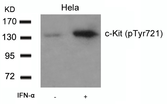 Rabbit anti-Phospho-c-Kit(Tyr721)Polyclonal Antibody