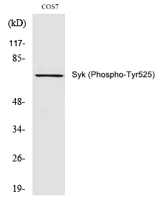 Rabbit anti-Phospho-Syk (Tyr525)Polyclonal Antibody