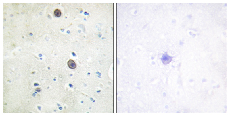 Rabbit anti-Phospho-Amyloid β A4 (Thr743/668)Polyclonal Antibody