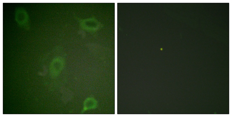 Rabbit anti-Phospho-Amyloid β A4 (Thr743/668)Polyclonal Antibody