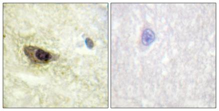 Rabbit anti-Phospho-MAP4 (Ser696)Polyclonal Antibody