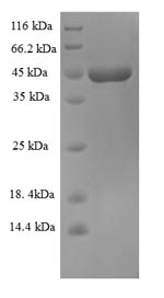 Recombinant Zaire Ebolavirus GP Protein (N-terminal 6xHis-SUMO)