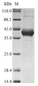 Recombinant Human MELK Protein (N-terminal 10xHis and C-terminal Myc)