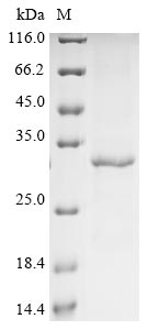 Recombinant Human CDK5 Protein (Tag-Free)