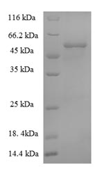 Recombinant African Cassava Mosaic Virus AC1 Protein (N-terminal 6xHis-SUMO)
