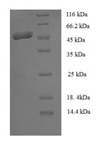 Recombinant Staphylococcus Aureus SSPB Protein (N-terminal GST)