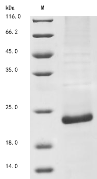 Recombinant Bovine Viral Diarrhea Virus Genome Polyprotein Protein (N-terminal 10xHis)