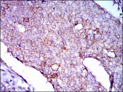 Mouse anti-LPA Monoclonal Antibody