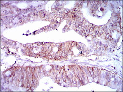 Mouse anti-LPA Monoclonal Antibody