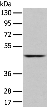 Rabbit anti-SLC2A6 Polyclonal Antibody