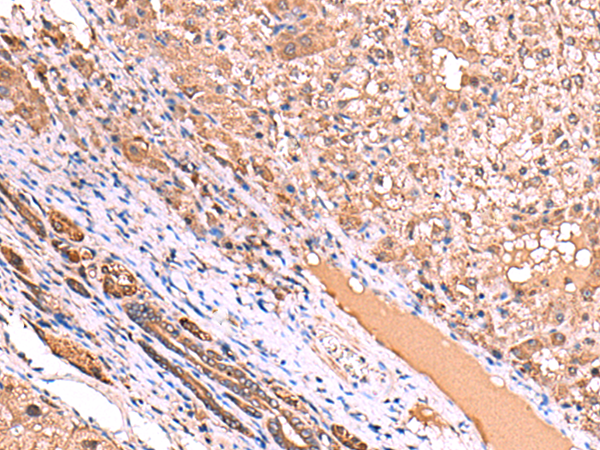 Rabbit anti-TTC38 Polyclonal Antibody