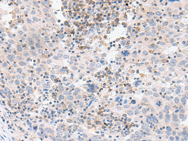 Rabbit anti-NPY1R Polyclonal Antibody