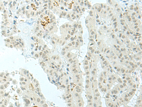 Rabbit anti-ESRP2 Polyclonal Antibody