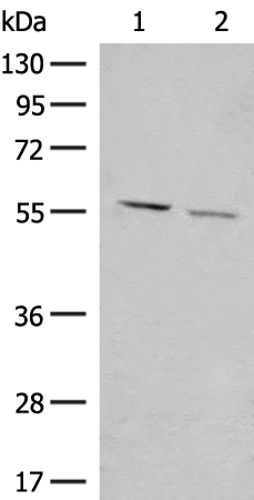 Rabbit anti-GADL1 Polyclonal Antibody