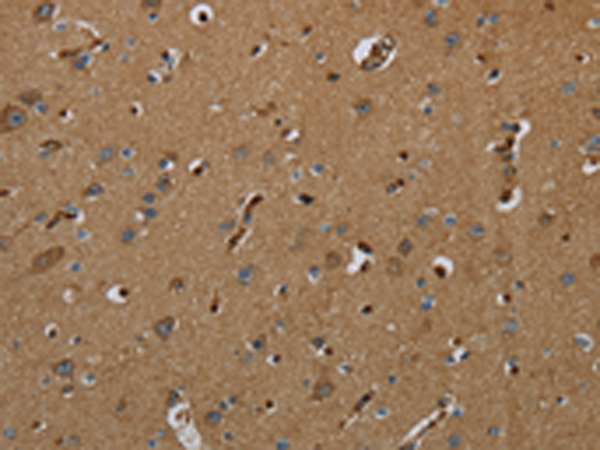 Rabbit anti-GBP5 Polyclonal Antibody