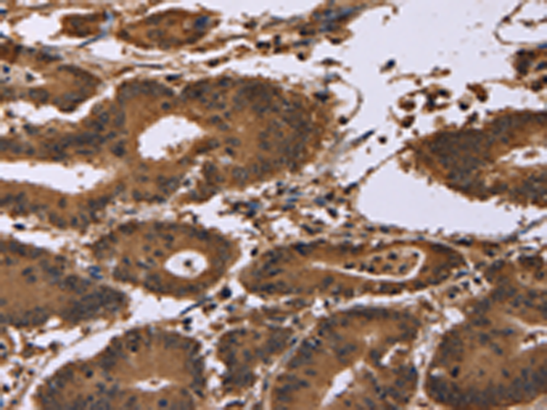 Rabbit anti-EDN2 Polyclonal Antibody