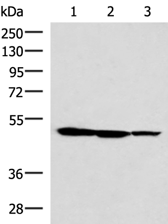 Rabbit anti-TTC38 Polyclonal Antibody