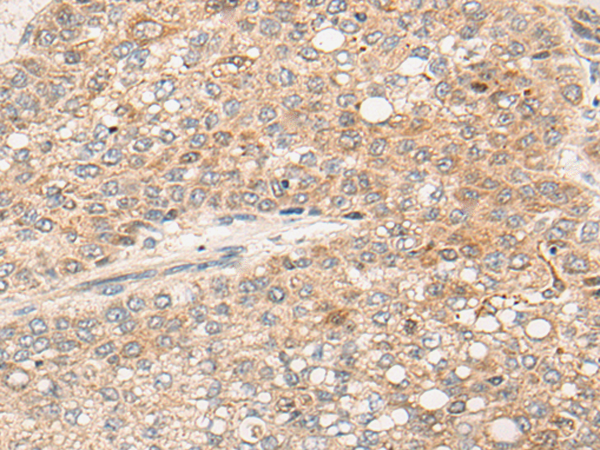 Rabbit anti-DIPK2B Polyclonal Antibody