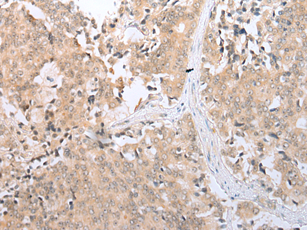 Rabbit anti-SLC2A6 Polyclonal Antibody