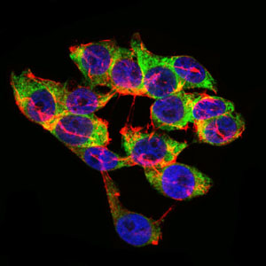 Mouse anti-LPA Monoclonal Antibody