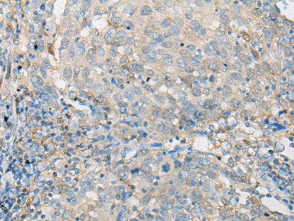 Rabbit anti-EFHD2 Polyclonal Antibody