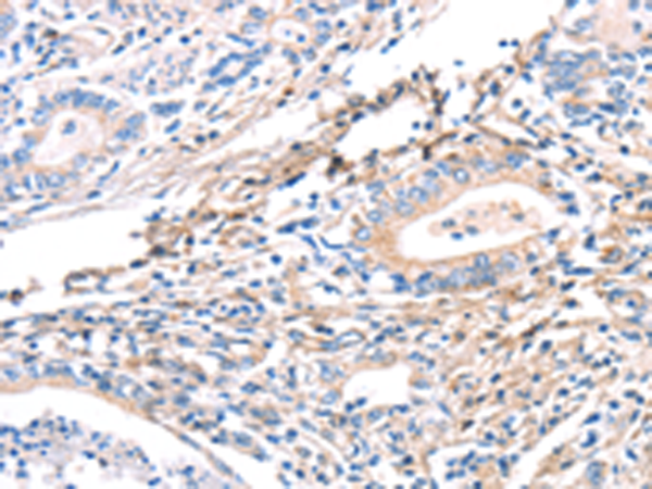 Rabbit anti-TWF2 Polyclonal Antibody
