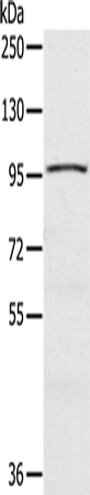 Rabbit anti-CIZ1 Polyclonal Antibody
