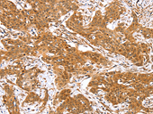 Rabbit anti-RGS22 Polyclonal Antibody