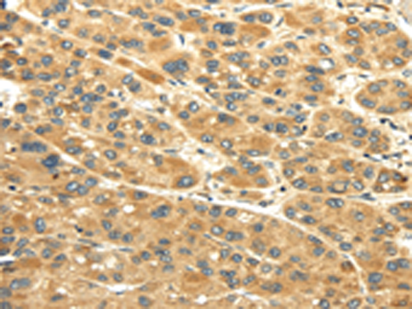 Rabbit anti-UACA Polyclonal Antibody