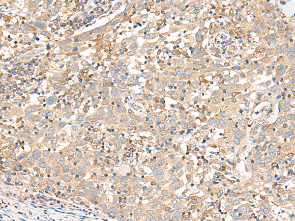 Rabbit anti-GADL1 Polyclonal Antibody