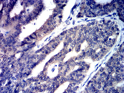 Mouse anti-CD258 Monoclonal Antibody