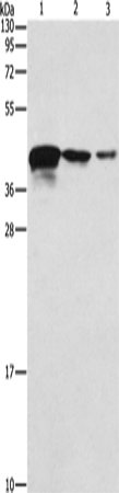 Rabbit anti-TWF2 Polyclonal Antibody
